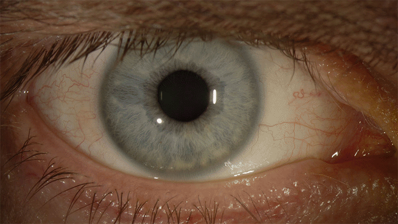 ebola_eye